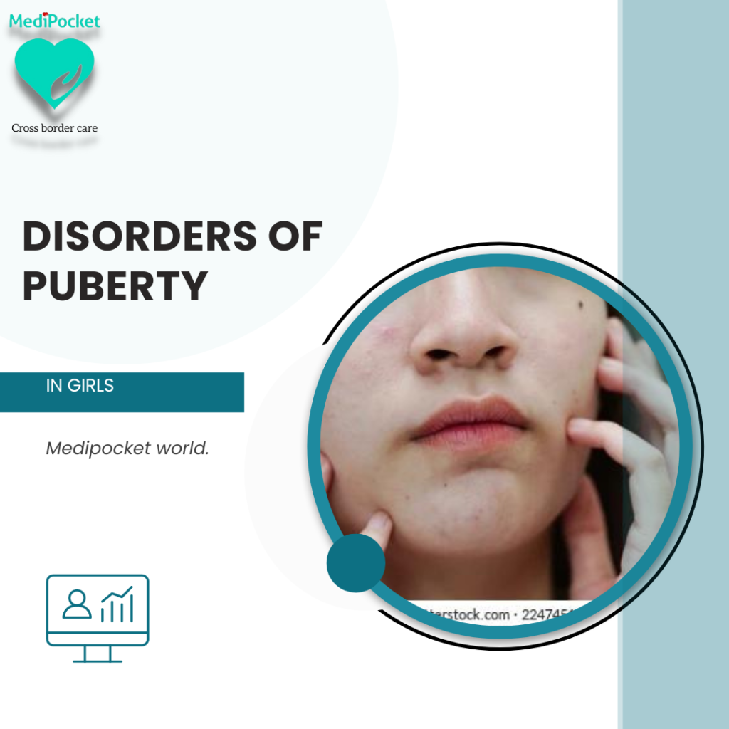 disorders of puberty