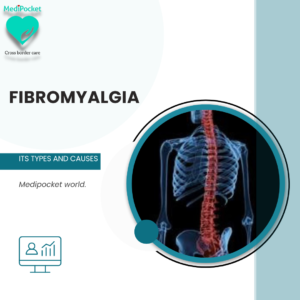 Fibromyalgia- Its causes and symptoms￼